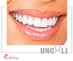 Slider image (2) Uncali Oral and Dental Clinic